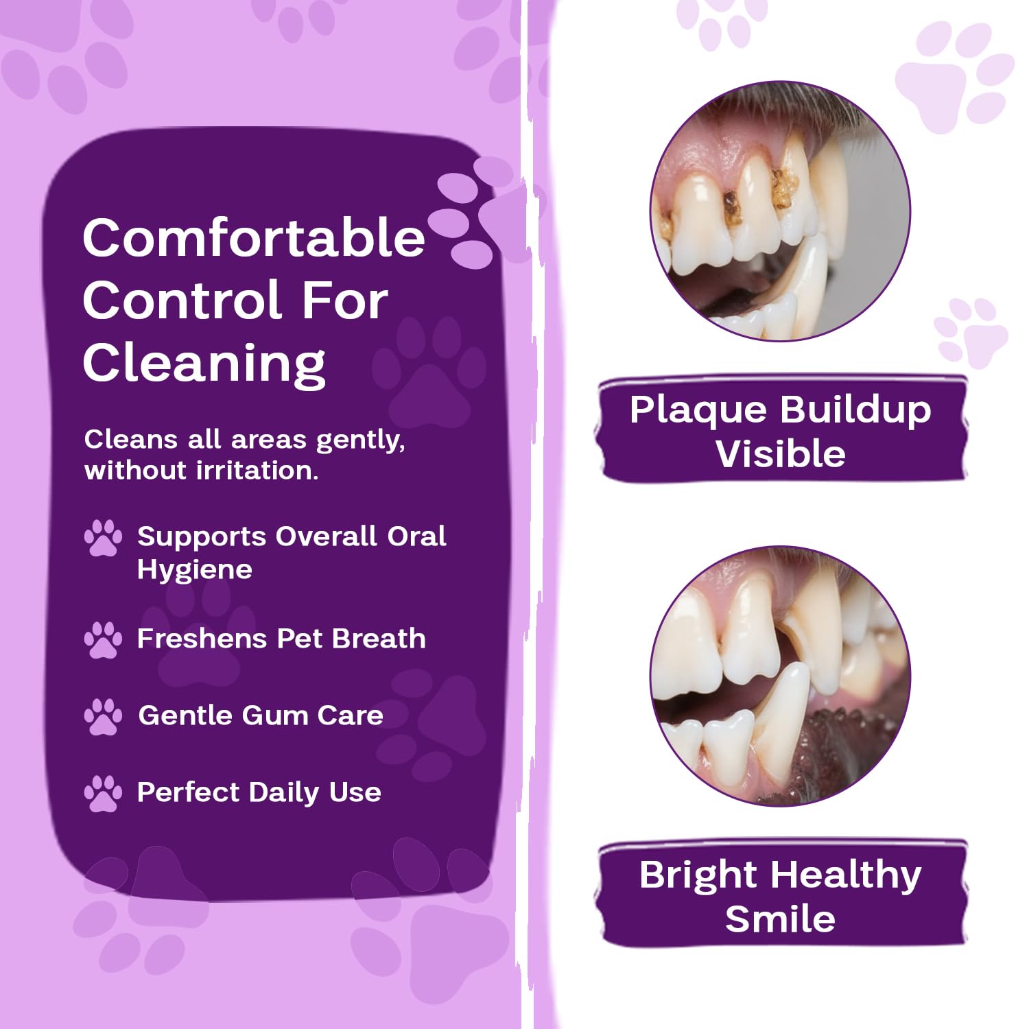 Zoila Pets Dental Wipes – Best Dog Teeth Cleaning, Dog Dental Wipes for Dogs Teeth, Finger Toothbrush for Dogs and Cats, Oral Care, Remove Plaque, Tartar & Bad Breath – 50 Count
